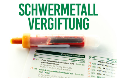 Schwermetallentgiftung, Chelat-Infusion, Ausleitung Therapie bei Ruloff Naturheilzentrum Landau